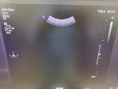 Ultrasound system(Color)｜EPIQ /Affiniti 70G｜Philips photo4