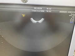 Ultrasound system(Color)｜Voluson S8｜GE Healthcare photo4
