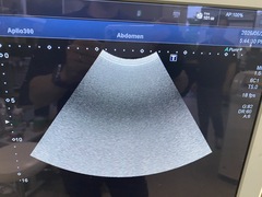超音波診断装置｜Aplio 300 TUS−A300｜キヤノンメディカルシステムズの写真4枚目