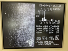 Specular microscope｜NSP-9900Ⅱ｜'' photo3