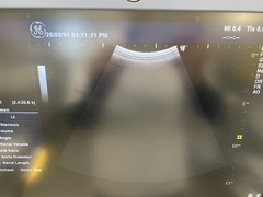 超音波診断装置（カラードプラ）｜LOGIQ P6｜GEヘルスケアの写真4枚目