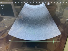 ｜Aplio 400 TUS-A400｜Canon Medical Systems photo4