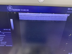 Ultrasound system｜LOGIQ A5｜GE Healthcare photo4