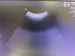 4D超音波診断装置（カラードプラ）｜Voluson E10｜GEヘルスケアの写真4枚目
