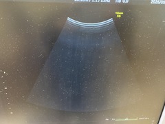 4D超音波診断装置（カラードプラ）｜Voluson S6｜GEヘルスケアの写真4枚目