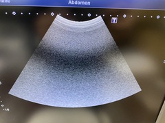 Ultrasound System(Color)｜Xario100 TUS-X100｜Canon Medical Systems photo4