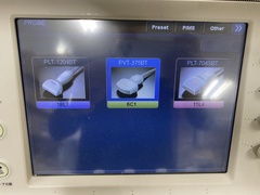 ｜Aplio 400 TUS-A400｜Canon Medical Systems photo4