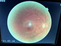 Non-Mydriatic Retinal Camera｜TRC-NW200｜Topcon photo5