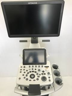 超音波診断装置｜ARIETTA 65｜日立製作所の写真5枚目
