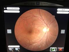 Fundus camera｜AFC-330｜'' photo5