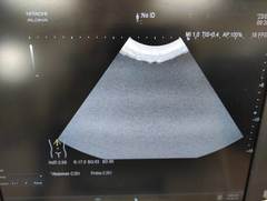Ultrasound system｜ARIETTA 60｜Hitachi photo5