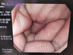 上部消化管汎用ビデオスコープ｜GIF-H260Z｜オリンパスメディカルシステムズ株式会社の写真5枚目