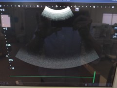 超音波診断装置｜Aplio 300 TUS−A300｜キヤノンメディカルシステムズの写真5枚目
