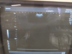 超音波診断装置（白黒）｜SSA-550A Nemio10｜キヤノンメディカルシステムズの写真5枚目