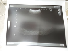 超音波診断装置（カラードプラ）｜SSA-590A  Nemio MX｜キヤノンメディカルシステムズの写真5枚目