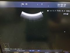 超音波診断装置｜F37｜日立製作所の写真5枚目