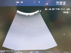 超音波診断装置｜F37｜日立製作所の写真5枚目