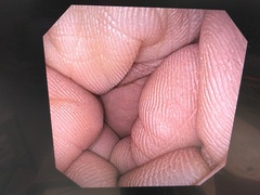 上部消化管経鼻スコープ｜GIF-XP170N｜オリンパスメディカルシステムズ株式会社の写真5枚目