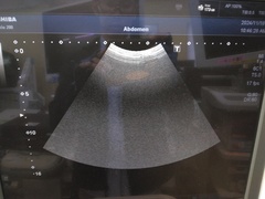 超音波診断装置（カラードプラ）｜XARIO 200 TUS‐X200｜キヤノンメディカルシステムズの写真5枚目