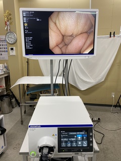 Processor｜EVIS X1 CV-1500｜Olympus Medical Systems photo5