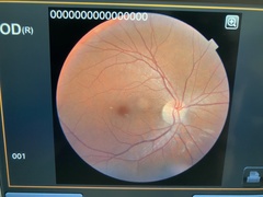 Non-Mydriatic Retinal Camera｜TRC-NW400｜Topcon photo5