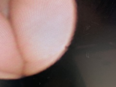 Bronchofiberscope｜BF-XP60｜Olympus Medical Systems photo5