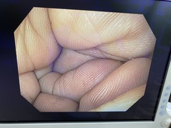 上部消化管汎用ビデオスコープ｜GIF-H170｜オリンパスメディカルシステムズ株式会社の写真5枚目