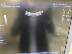 超音波診断装置（カラードプラ）｜LOGIQ P6｜GEヘルスケアの写真5枚目