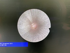 Endoscopey System｜VISERA ELITE(OTV-S190＆CLV-S190）｜Olympus Medical Systems photo5