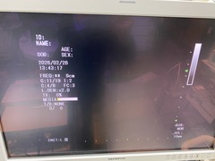 内視鏡用超音波観測装置｜EU-ME1｜オリンパスメディカルシステムズ株式会社の写真5枚目