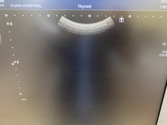超音波診断装置（カラードプラ）｜XARIO 200 TUS‐X200｜キヤノンメディカルシステムズの写真5枚目