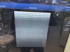 超音波診断装置｜Aplio 300 TUS−A300｜キヤノンメディカルシステムズの写真5枚目