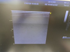 超音波診断装置｜Vivid T8｜GEヘルスケアの写真5枚目