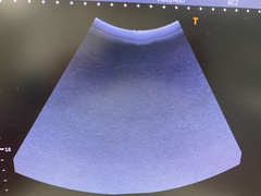 Ultrasound system｜Viamo c100 TUS－VC100｜Canon Medical Systems photo5