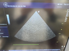 超音波診断装置（カラードプラ）｜LOGIQ P6｜GEヘルスケアの写真5枚目