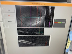 Optical Coherence Tomography｜RS-3000｜'' photo5