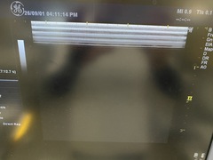 超音波診断装置（カラードプラ）｜LOGIQ P6｜GEヘルスケアの写真5枚目