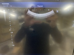 ｜Aplio 400 TUS-A400｜Canon Medical Systems photo5