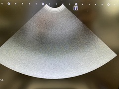 Ultrasound system｜Aplio 300 TUS−A300｜Canon Medical Systems photo5