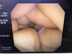 上部消化管経鼻ビデオスコープ｜GIF-N260｜オリンパスメディカルシステムズ株式会社の写真6枚目