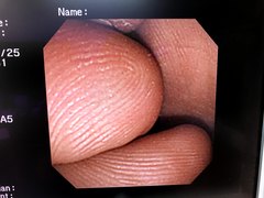 Video Duodenoscope｜JF-260V｜Olympus Medical Systems photo6