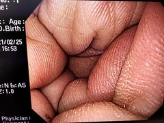 Video Gastroscope｜GIF-Q260｜Olympus Medical Systems photo6