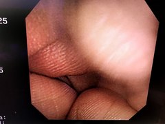 Video Gastroscope｜GIF-XP260｜Olympus Medical Systems photo6