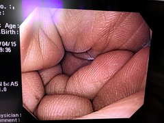 Video Gastroscope｜GIF-Q260｜Olympus Medical Systems photo6