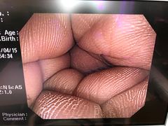 Video Colonoscope｜CF-Q240I｜Olympus Medical Systems photo6