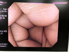 Video Gastroscope｜GIF-H260Z｜Olympus Medical Systems photo6