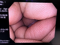 Video Colonoscope｜PCF-Q260AZI｜Olympus Medical Systems photo6