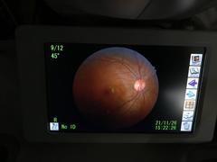 Retinal Camera｜VX-20α｜kowa photo6