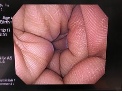 上部消化管汎用ビデオスコープ｜GIF-PQ260｜オリンパスメディカルシステムズ株式会社の写真6枚目