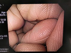 上部消化管汎用ビデオスコープ｜GIF-H260｜オリンパスメディカルシステムズ株式会社の写真6枚目